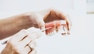 Care for Dental Implants: Common Mistakes and How to Avoid Them