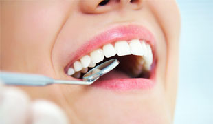 What Are the Causes of Tooth Decay